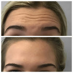 Charger l'image dans la galerie, Botox Naturel  Sérum Anti-Âge Rapide et Efficace

