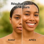 Charger l'image dans la galerie, Sérum Anti-Taches Anua – Une Peau Plus Claire et Uniforme dès 14 Jours
