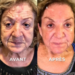 Charger l'image dans la galerie, Botox Naturel  Sérum Anti-Âge Rapide et Efficace
