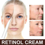 Charger l'image dans la galerie, EELHOE Retinol Face Cream – Anti-Rides
