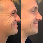Charger l'image dans la galerie, Botox Naturel  Sérum Anti-Âge Rapide et Efficace
